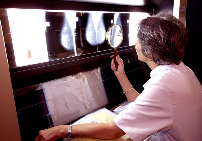 Een radioloog beoordeelt analoge borstfoto’s