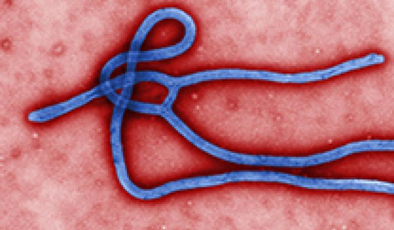 ebolavirus