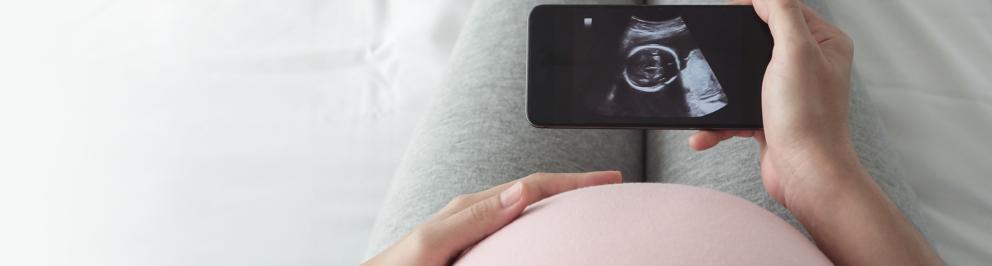 Banner Monitoren zwangerschap en geboorte